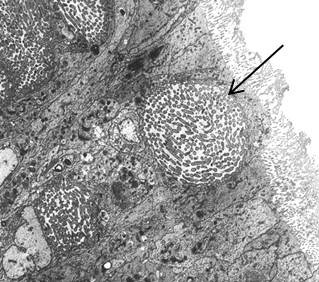 Abalone gut tissue