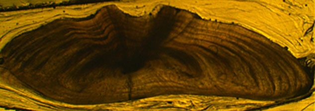 Otolith section from 7-year-old California halibut. CDFW file photo. Otolith section from 7-year-old California halibut. CDFW file photo.